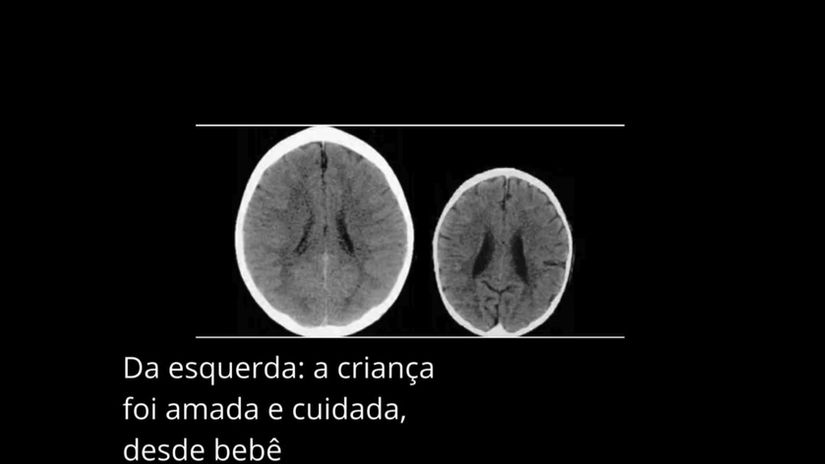 Inteligência e Afetividade